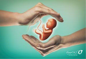 افزایش درمان زوج‌های نابارور گیلان با IVF